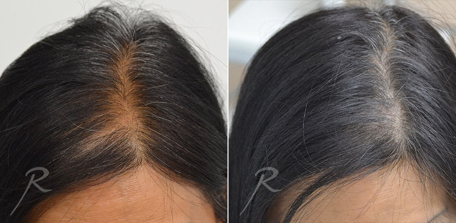 Havelyn Hair Oil