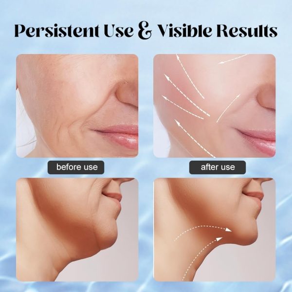 Light Face Massager/Therapy